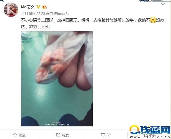 女主播誤食煙花崩掉四顆牙：就是不用瘦臉針