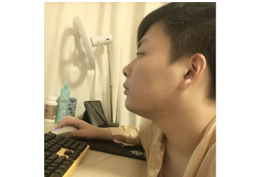 西卡回歸LPL解說